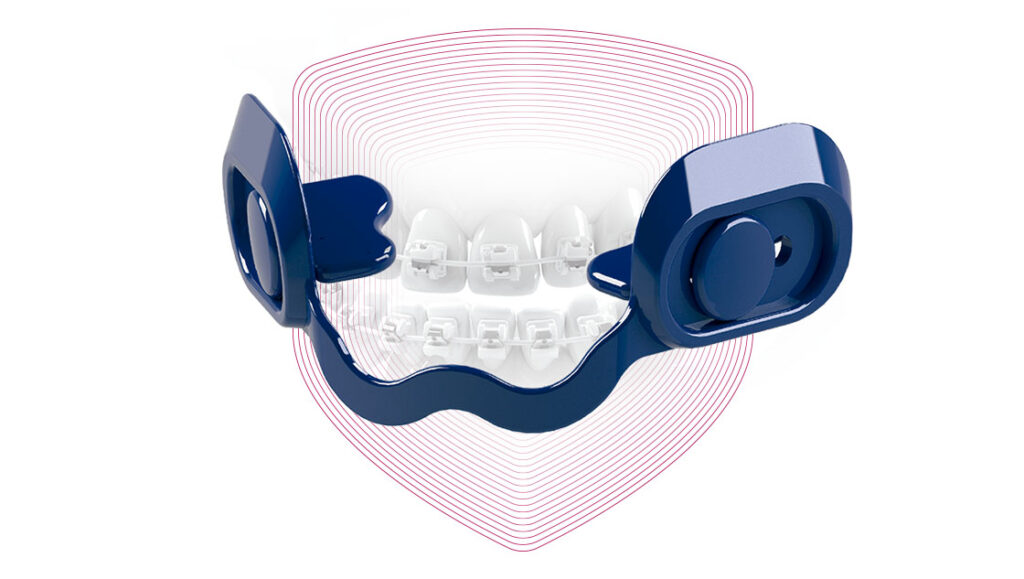 images_ortho_boca_ortho